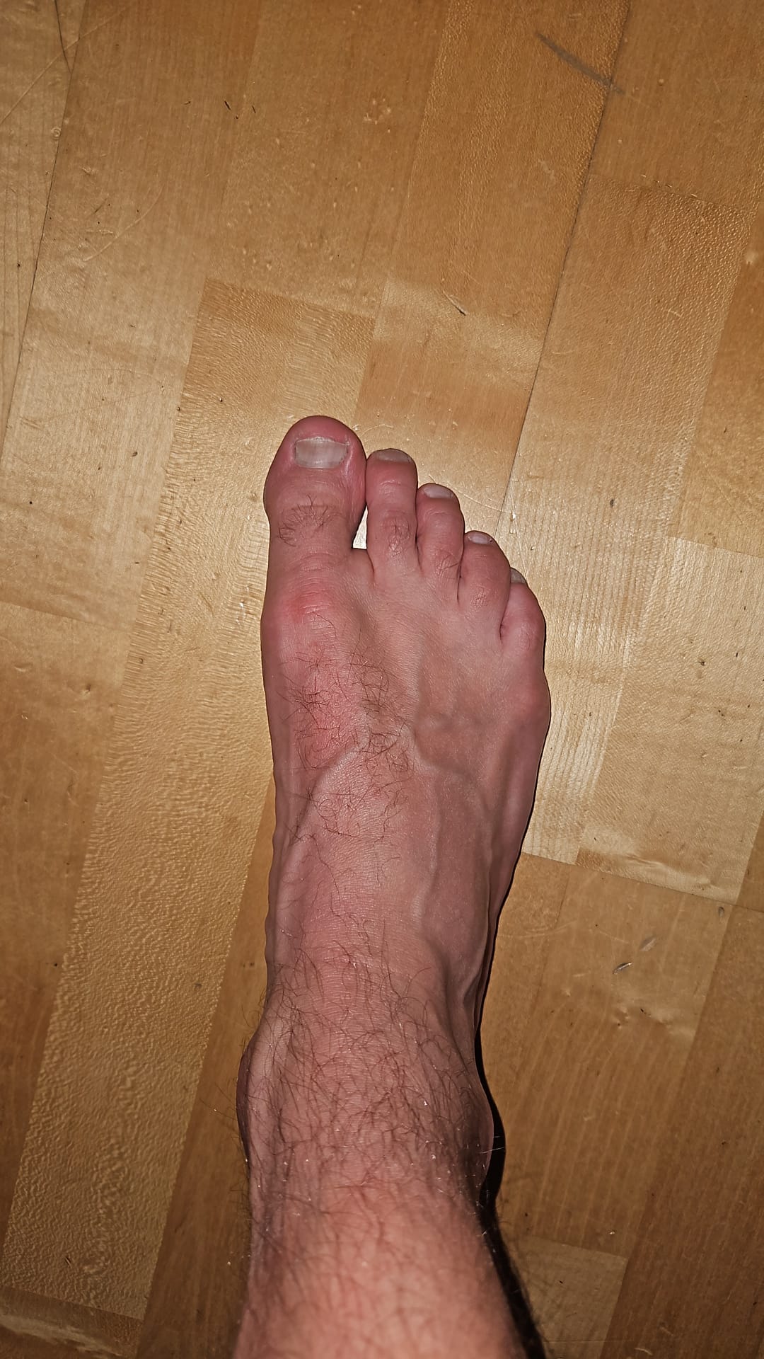 Zusatzfoto des Scans