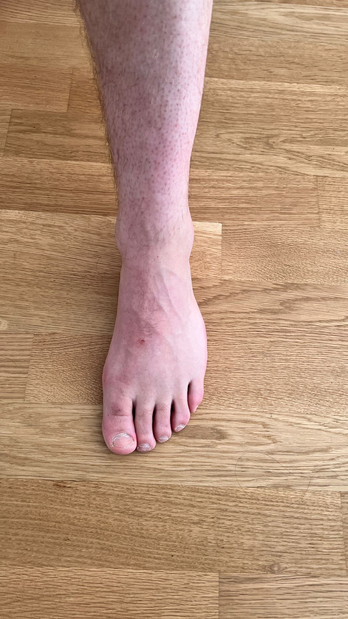 Zusatzfoto des Scans