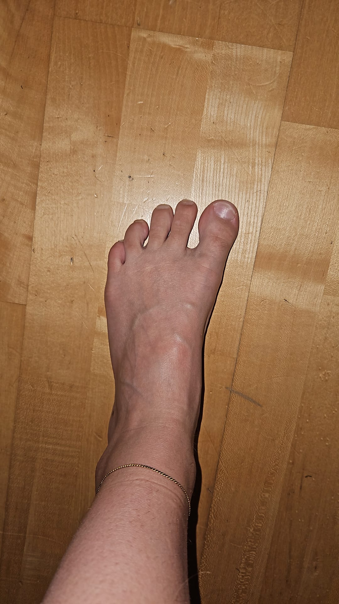 Zusatzfoto des Scans